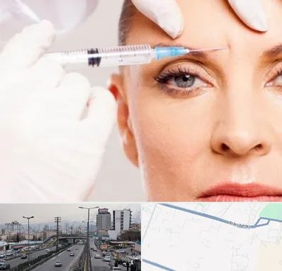 مزوژل در بلوار ارتش