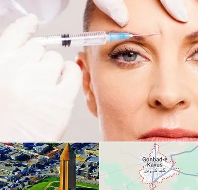 مزوژل در گنبد کاووس