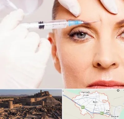 مزوژل در بم