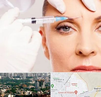 مزوژل در عظیمیه کرج 