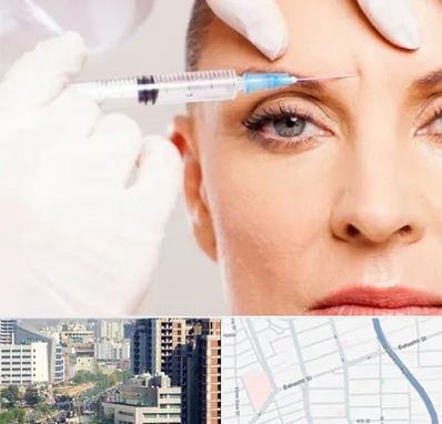 مزوژل در خیابان بهشتی