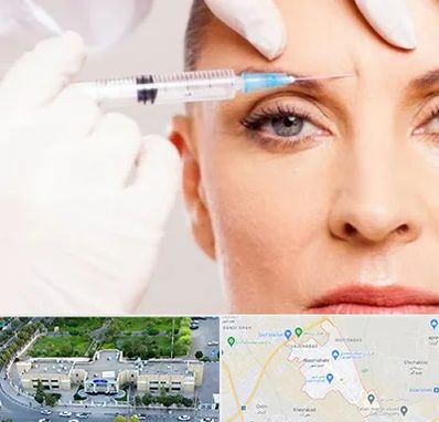 مزوژل در نسیم شهر