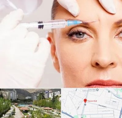 مزوژل در بلوار تعاون