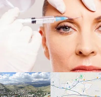 مزوژل در رودهن