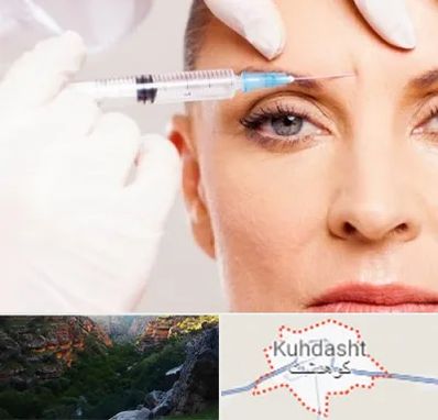 مزوژل در کوهدشت