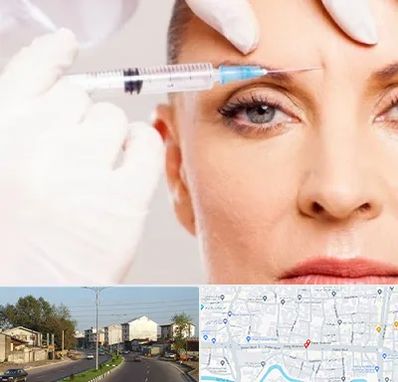 مزوژل در ضیابری رشت