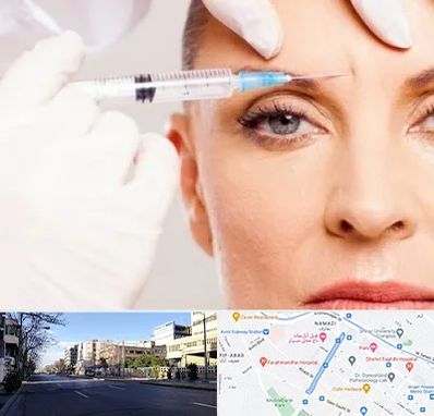 مزوژل در خیابان ملاصدرا شیراز