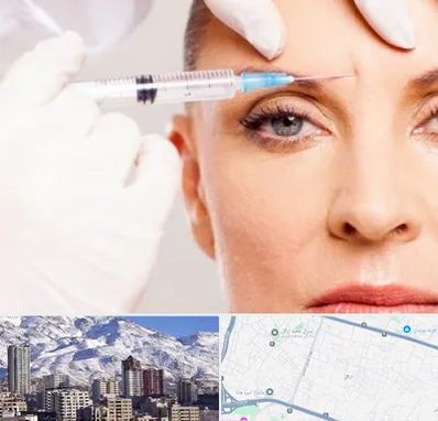 مزوژل در ازگل