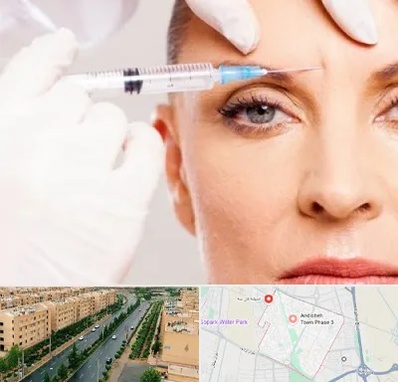 مزوژل در فاز سه اندیشه