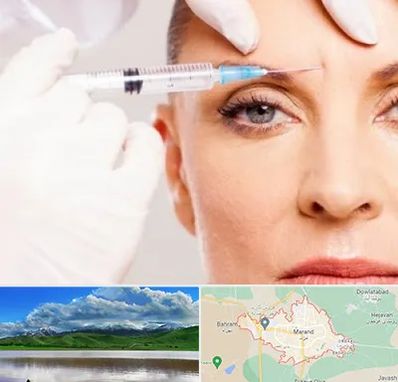 مزوژل در مرند