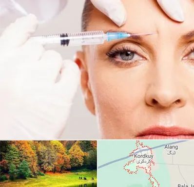 مزوژل در کردکوی