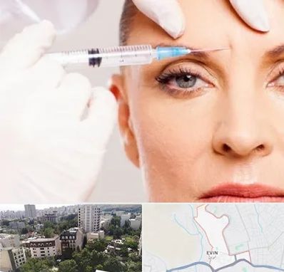 مزوژل در اوین