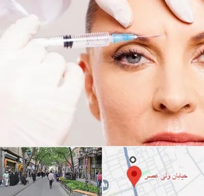 مزوژل در ولیعصر شهریار