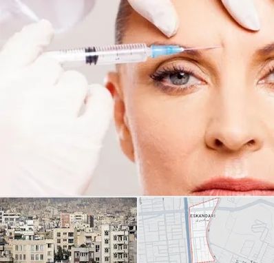 مزوژل در اسکندری