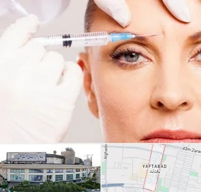 مزوژل در یافت آباد