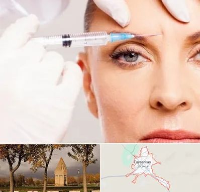 مزوژل در تویسرکان