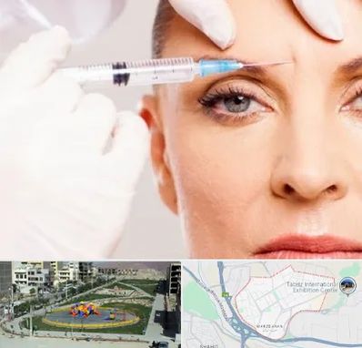 مزوژل در مرزداران تبریز