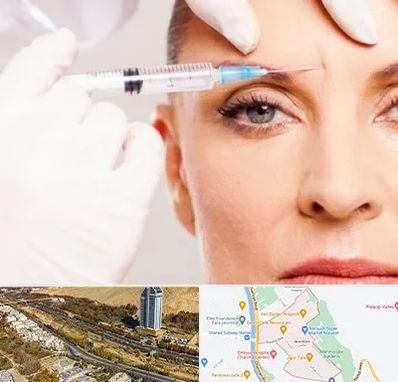 مزوژل در خیابان نیایش شیراز