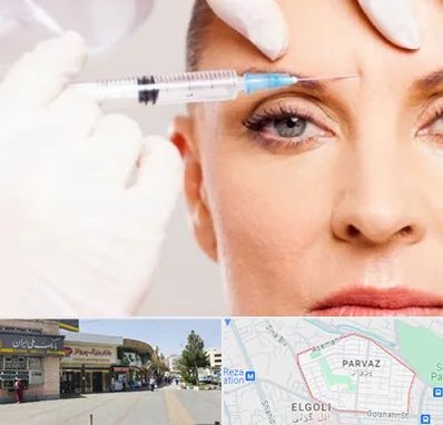 مزوژل در پرواز تبریز