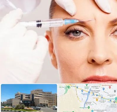 مزوژل در صیاد شیرازی مشهد