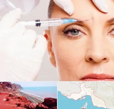مزوژل در هرمزگان