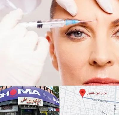 مزوژل در امین حضور