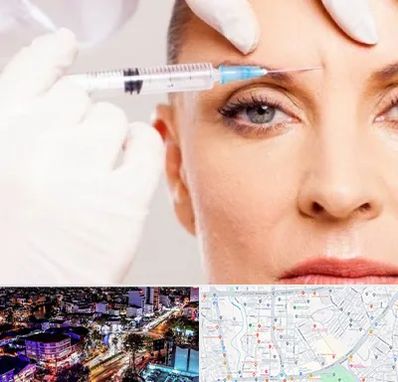 مزوژل در منظریه رشت