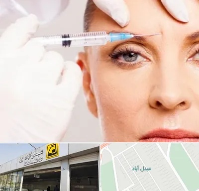 مزوژل در عبدل آباد