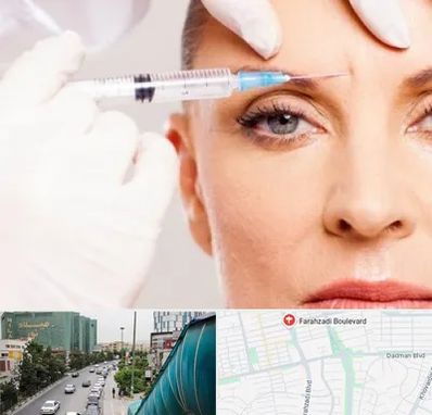 مزوژل در بلوار فرحزادی