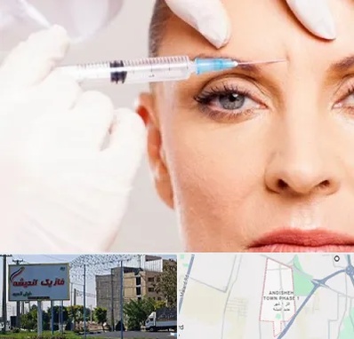 مزوژل در فاز یک اندیشه