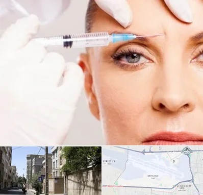 مزوژل در مهرآباد