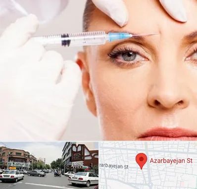 مزوژل در خیابان آذربایجان