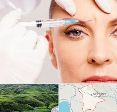مزوژل در گچساران