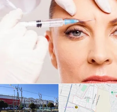 مزوژل در فاز دو اندیشه