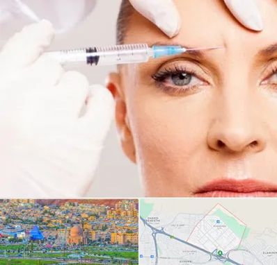 مزوژل در رشدیه تبریز