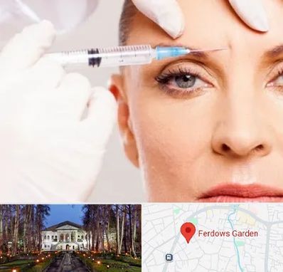 مزوژل در باغ فردوس