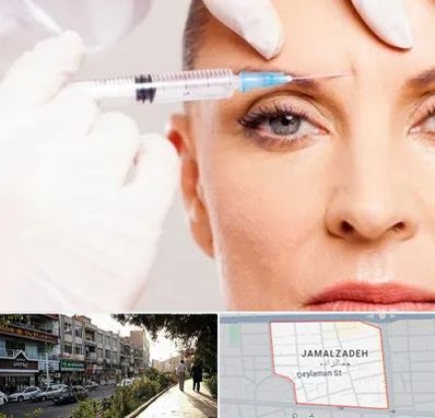مزوژل در خیابان جمالزاده