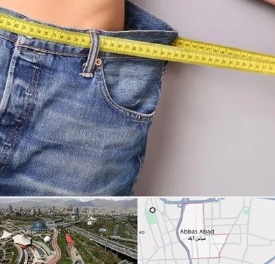 عمل لیپوماتیک در عباس آباد تهران