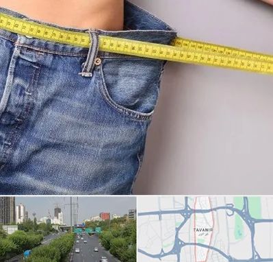 عمل لیپوماتیک در توانیر