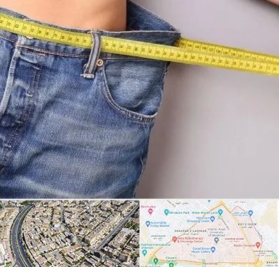 عمل لیپوماتیک در شهرک غرب مشهد