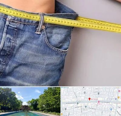 عمل لیپوماتیک در هشت بهشت اصفهان