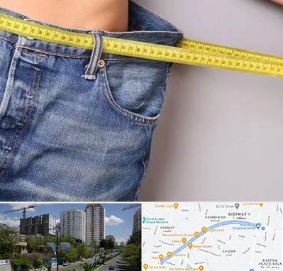 عمل لیپوماتیک در اندرزگو