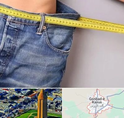 عمل لیپوماتیک در گنبد کاووس