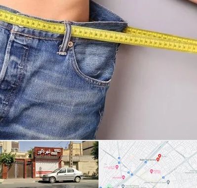 عمل لیپوماتیک در باجک قم