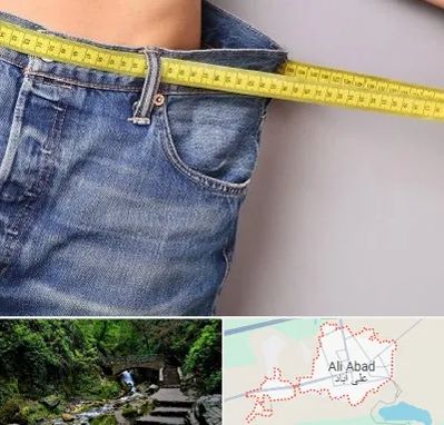 عمل لیپوماتیک در علی آباد کتول