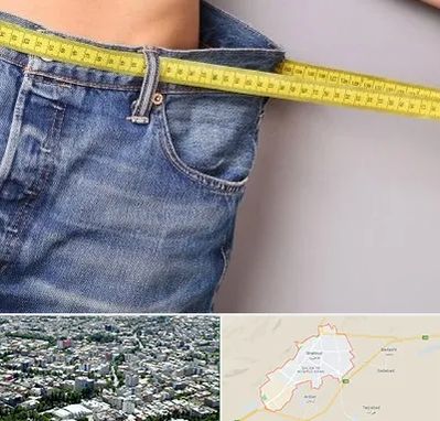 عمل لیپوماتیک در شاهرود