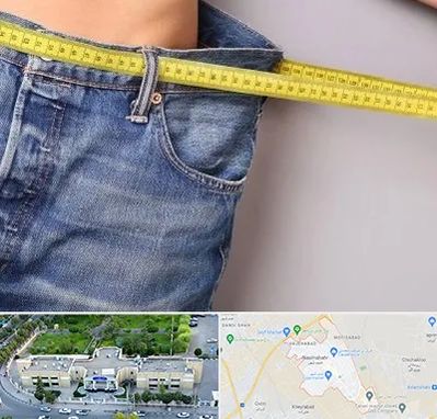 عمل لیپوماتیک در نسیم شهر