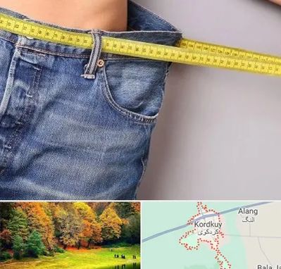 عمل لیپوماتیک در کردکوی