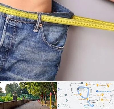 عمل لیپوماتیک در فلکه گاز رشت