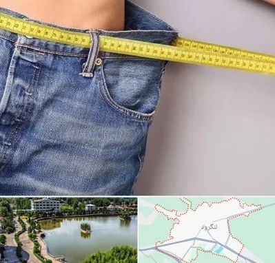 عمل لیپوماتیک در لنگرود